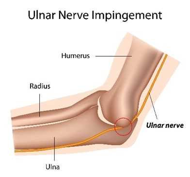 printable tendon gliding exercises