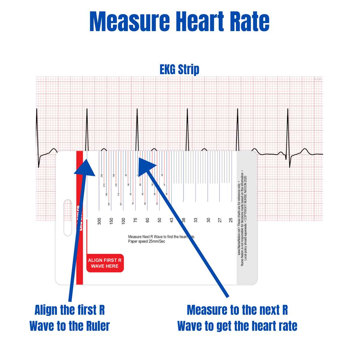 printable ekg cheat sheet