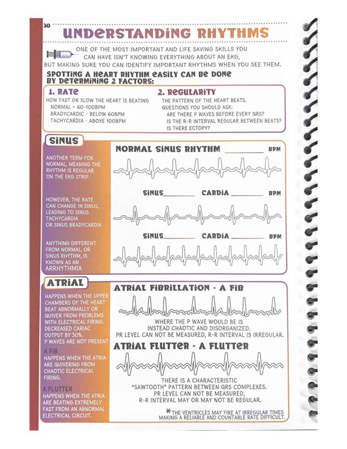 printable ekg cheat sheet